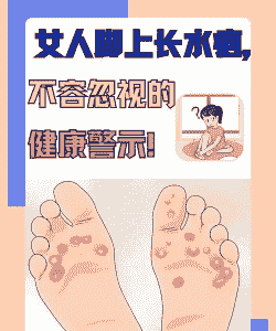 水仙病毒病的症状及防治症状