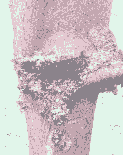 尾叶桉主要病虫害防治