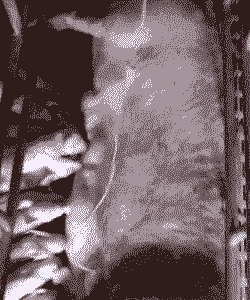 母猪产后输液输几天合适