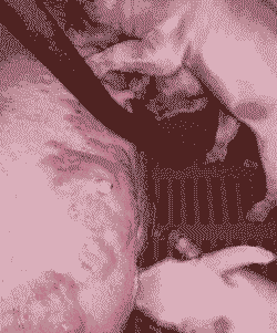 母猪产后身上有红痘