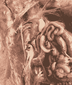 肉鸡感染厌氧菌