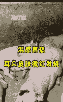 猪耳朵发红是什么病