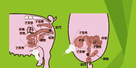 母猪的产后物理