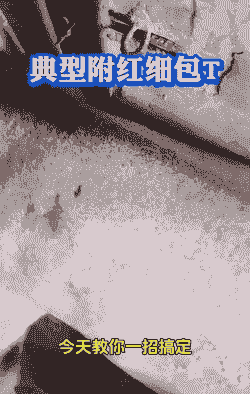 母猪产后发烧怎么防止