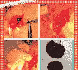 母猪产后外阴血肿的