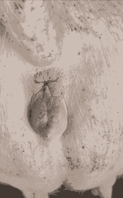 母猪产后第五天发育不好