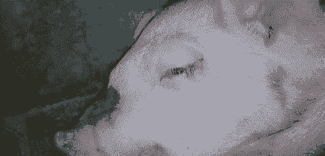 猪水肿出现什么症状