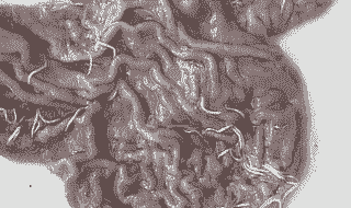 猪身上有什么虫