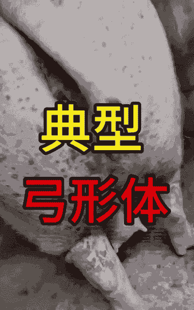 母猪弓背什么病引起