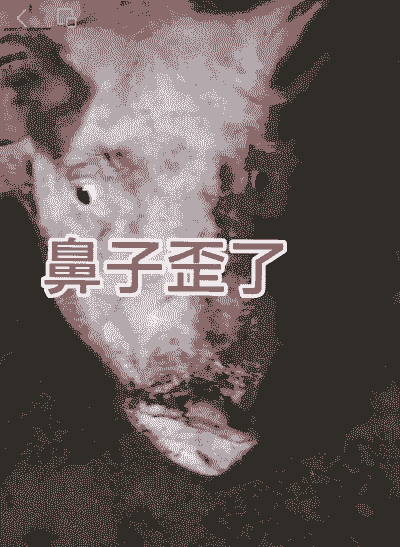 小猪流鼻涕什么病