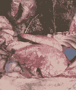 猪仔大肚子什么病