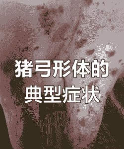 猪得了什么病会发热