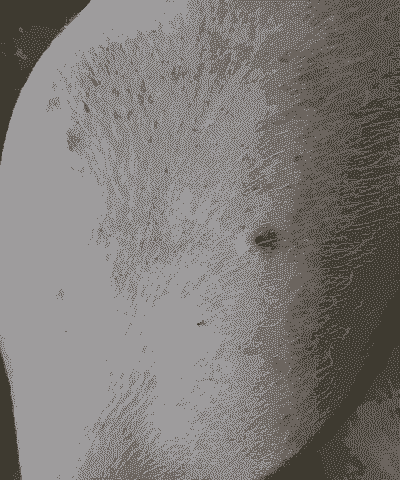 猪复出病是什么症状