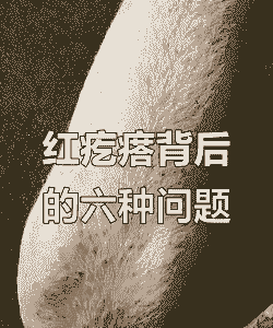 猪身上起包什么病