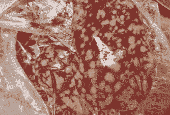 鸡什么病导致鸡肝发黑