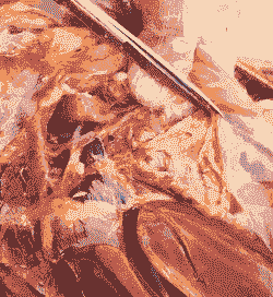 鸡气囊是什么东西