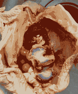 鸡场肉鸡肚皮发紫