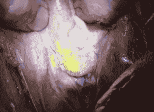 肉鸡法氏囊高发期