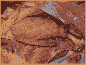 肉鸡安卡拉肝脏病理