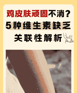 肉鸡vc缺乏症状