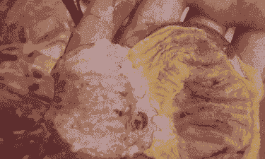 肉鸡缐胃炎会死鸡吗