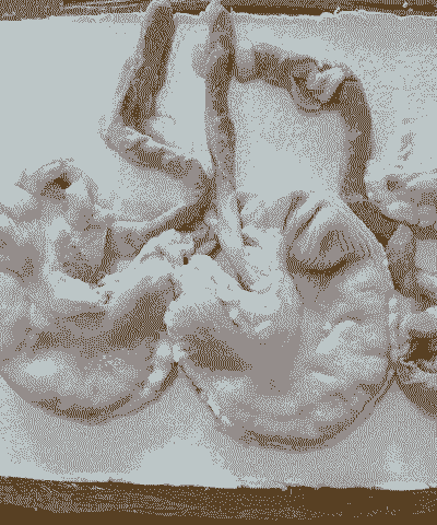 母猪产后小猪的脐带