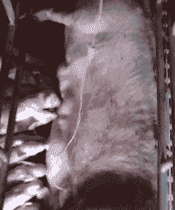 母猪产后输液配方