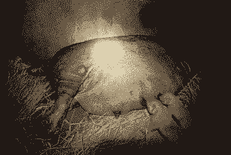 产后母猪站不起